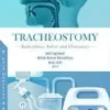 Tracheostomy: Indications, Safety and Outcomes