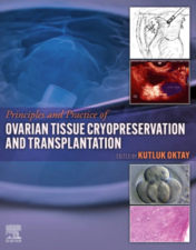 Principles and Practice of Ovarian Tissue Cryopreservation and Transplantation 1st Edition 2022 Original PDf