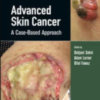 Advanced Skin Cancer A Case-Based Approach 2022 Original pdf