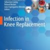 Infection in Knee Replacement 2022 Original pdf