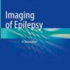 Imaging of Epilepsy A Clinical Atlas 2022 Original pdf