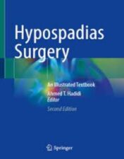 Hypospadias Surgery An Illustrated Textbook 2022 Original pdf