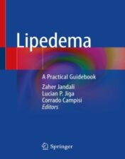 Lipedema A Practical Guidebook 2022 Original pdf