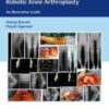 Computer Navigated and Handheld Robotic Knee Arthroplasty: An Illustrative Guide is a compendium of principles and practices of using technology to improve outcomes of partial and total knee arthroplasty.
