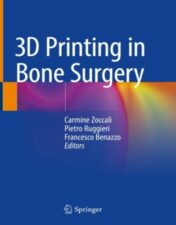 3D Printing in Bone Surgery 2022 Original pdf