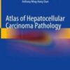 Atlas of Hepatocellular Carcinoma Pathology 2022 Original pdf