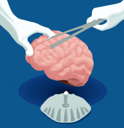 Brain Surgery Technology