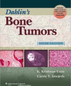 Dahlin’s Bone Tumors: General Aspects and Data on 10,165 Cases, 6th Edition