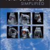 Fetal Cardiology Simplified ()