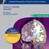 Pocket Atlas of Sectional Anatomy, Volume I: Head and Neck: Computed Tomography and Magnetic Resonance Imaging, 4th Edition ()