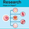 Stem Cell Research: Hope or Hype?