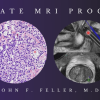 2021 Prostate MRI (Program 1) – John F. Feller, M.D