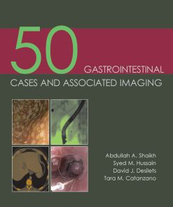 50 Gastrointestinal Cases and Associated Imaging ()