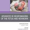 Advances in Neuroimaging of the Fetus and Newborn, An Issue of Clinics in Perinatology (Volume 49-3) (The Clinics: Internal Medicine, Volume 49-3)
