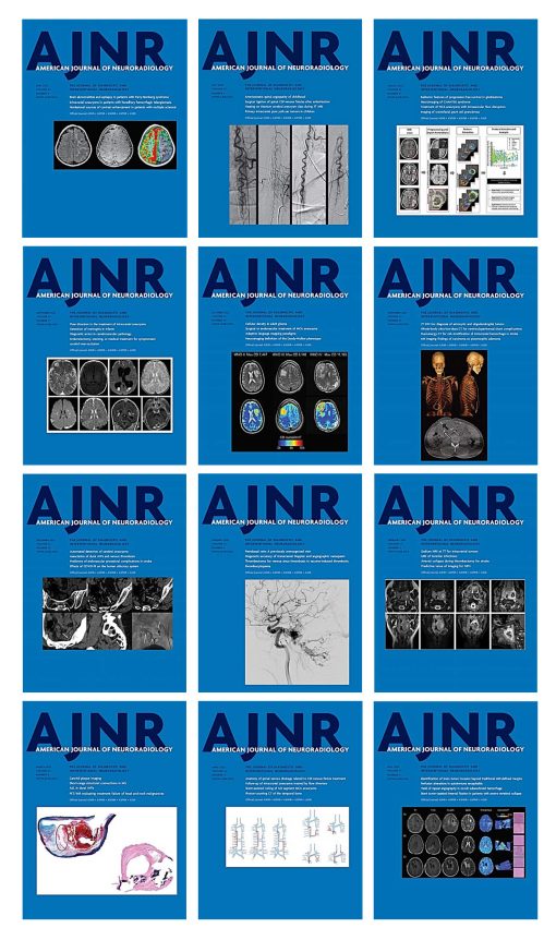 American journal of Neuroradiology 2022 Full Archives