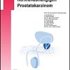 Androgenblockade beim hormonabhängigen Prostatakarzinom (UNI-MED Science) (German Edition)