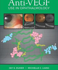 Anti-VEGF Use in Ophthalmology