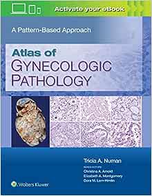 Atlas of Gynecologic Pathology: A Pattern-Based Approach ()