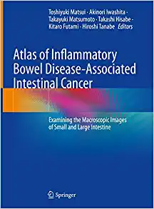 Atlas of Inflammatory Bowel Disease-Associated Intestinal Cancer: Examining the Macroscopic Images of Small and Large Intestine ()