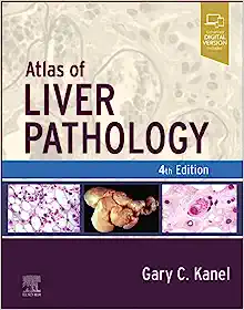 Atlas of Liver Pathology, 4th edition
