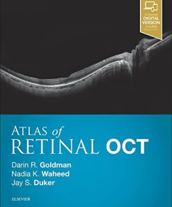 Atlas of Retinal OCT: Optical Coherence Tomography, 1e