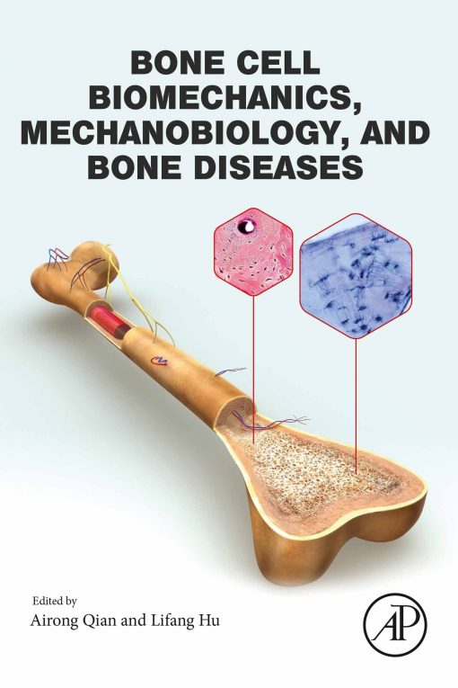 Bone Cell Biomechanics, Mechanobiology and Bone Diseases
