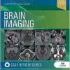 Brain Imaging: Case Review Series, 3rd edition