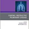 Chronic Obstructive Pulmonary Disease, An Issue of Clinics in Chest Medicine (Volume 41-3) (The Clinics: Internal Medicine, Volume 41-3)