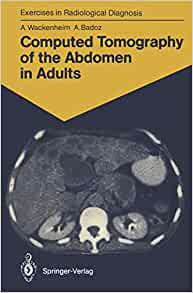 Computed Tomography of the Abdomen in Adults: 85 Radiological Exercises for Students and Practitioners (Exercises in Radiological Diagnosis)