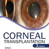 Corneal Transplantation, 3rd edition