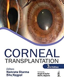 Corneal Transplantation, 3rd edition