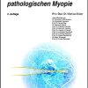 Diagnose und Therapie der pathologischen Myopie (UNI-MED Science) (German Edition), 2nd Edition