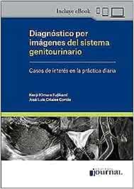 Diagnóstico por Imágenes del Sistema Genitourinario. Casos de Interés en la Práctica Diaria (High Quality Image PDF)