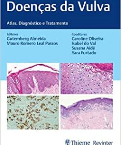 Doenças da Vulva: Atlas, Diagnóstico e Tratamento ()