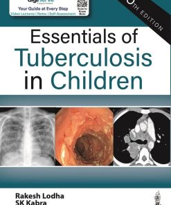 Essentials of Tuberculosis in Children, 5th Edition