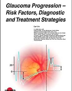 Glaucoma Progression – Risk Factors, Diagnostic and Treatment Strategies (UNI-MED Science)