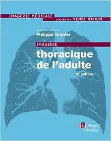 Imagerie Thoracique De L’adulte (French Edition), 4th edition