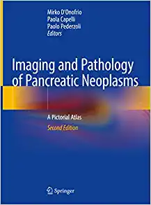 Imaging and Pathology of Pancreatic Neoplasms: A Pictorial Atlas, 2nd Edition ()