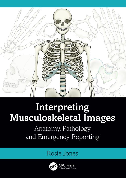 Interpreting Musculoskeletal Images ()