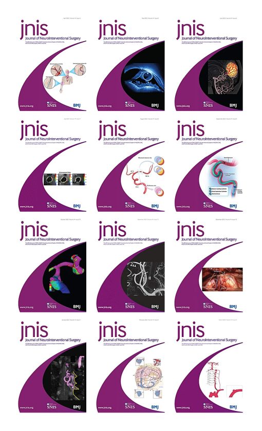 Journal of NeuroInterventional Surgery 2022 Full Archives