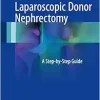 Laparoscopic Donor Nephrectomy: A Step-by-Step Guide