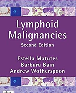 Lymphoid Malignancies, 2nd edition