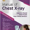 Manual of Chest X-ray, Volume 2 ( Modules 3 and 4 )
