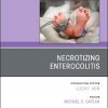 Necrotizing Enterocolitis, An Issue of Clinics in Perinatology (Volume 46-1) (The Clinics: Orthopedics, Volume 46-1)