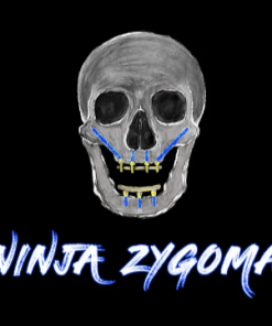 Ninja Zygoma – Implant Ninja