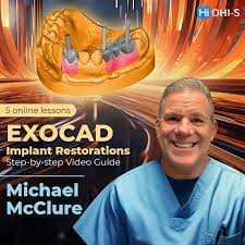 OHI-S EXOCAD Implant Restorations – Step-by-step Video Guide 2023
