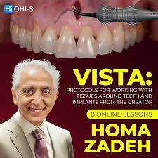 OHI-S VISTA: protocols for working with tissues around teeth and implants from the creator