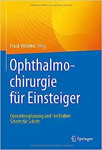 Ophthalmochirurgie für Einsteiger: Operationsplanung und -techniken Schritt für Schritt (German Edition)