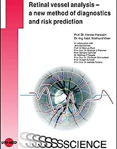 Retinal vessel analysis – a new method of diagnostics and risk prediction (UNI-MED Science)