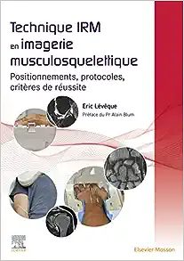 Technique IRM en imagerie musculosquelettique: Positionnements, protocoles, critères de réussite